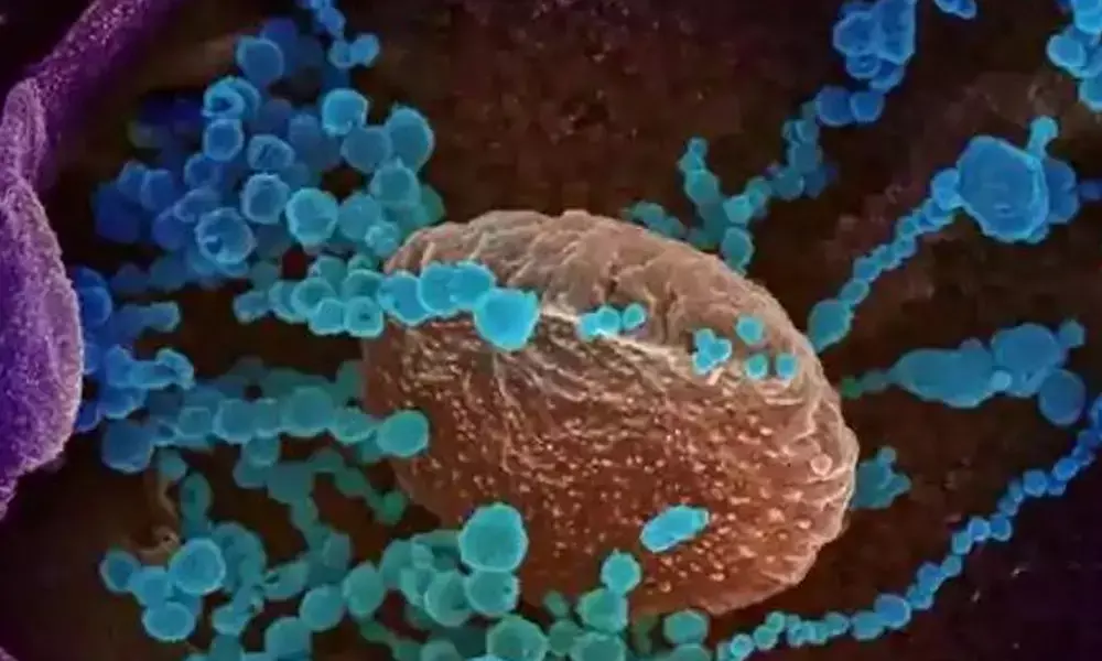 IIT-Kgp finds method to study changes in virus-hit lung cells