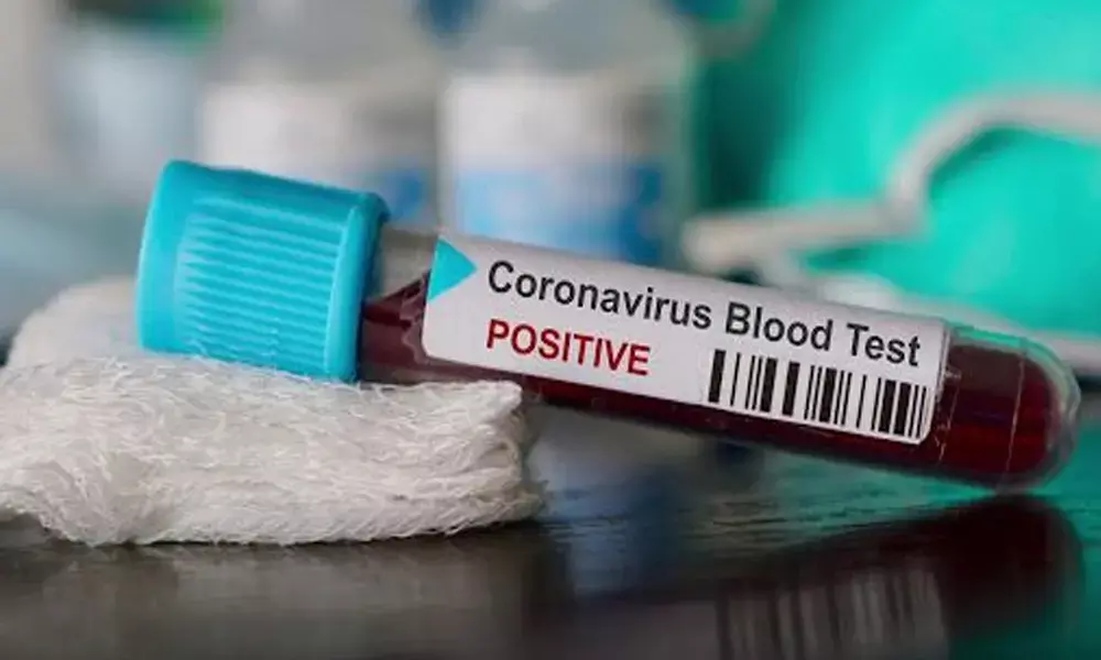 Covid positivity rate dips to 16.98%