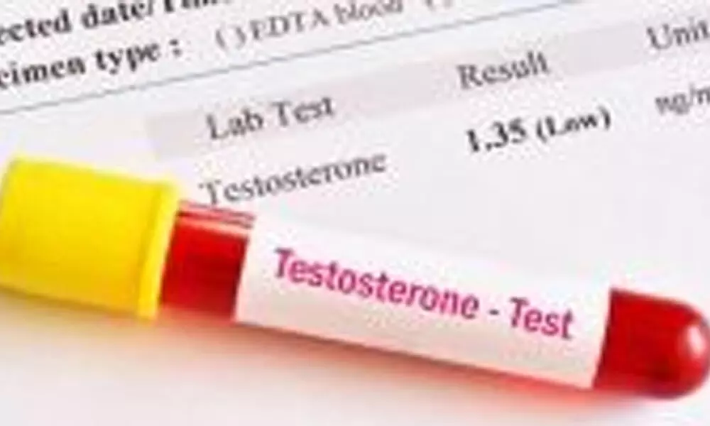 Low testosterone in men links to high Covid risk