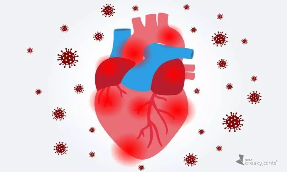 Heart inflammation more common after Covid Heart inflammation more common after Covid