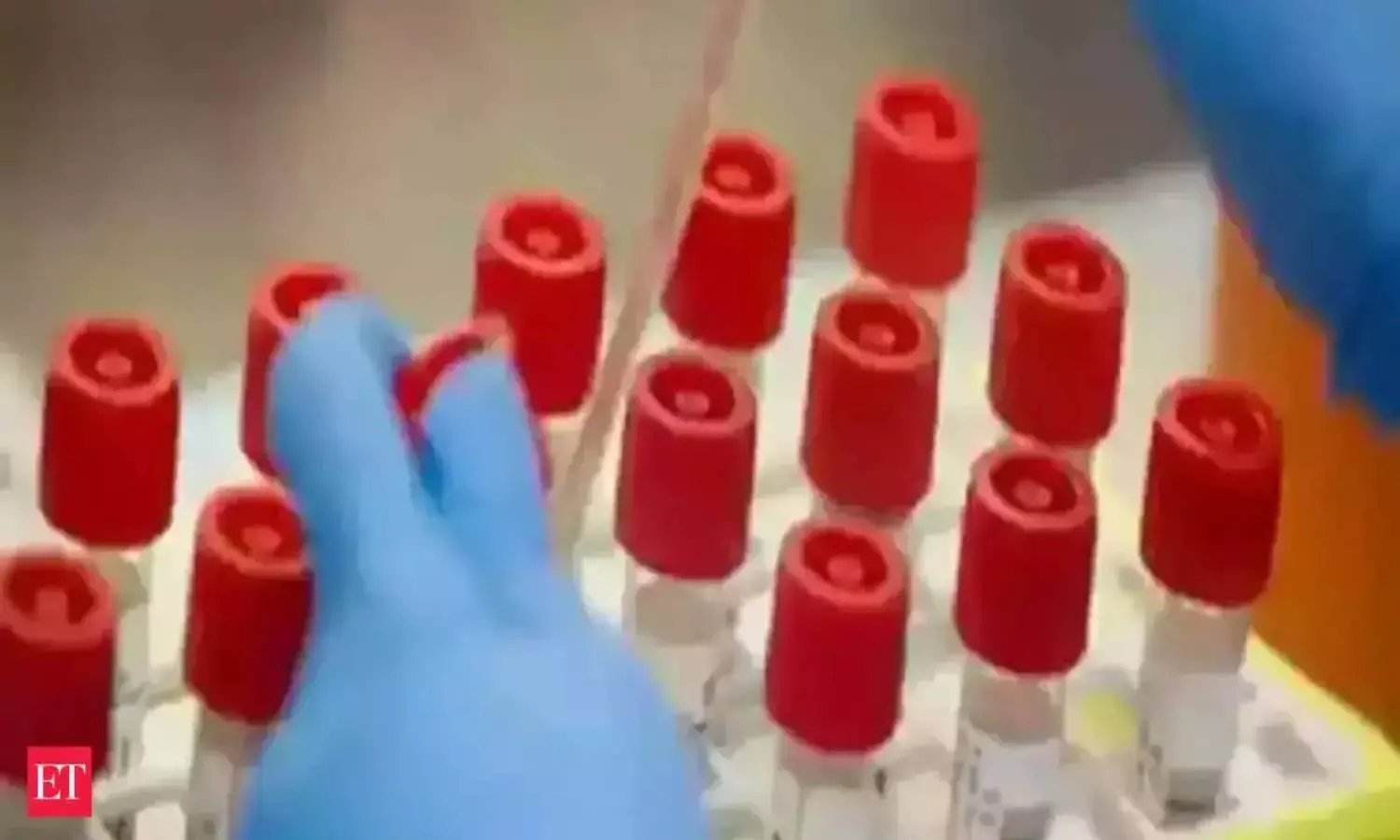 SRL Diagnostics to expand laboratory and collection centres network by 2023