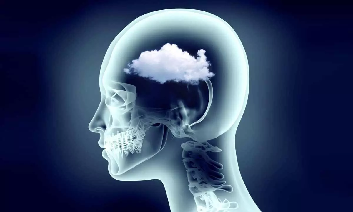 What is brain fog and how to treat it?