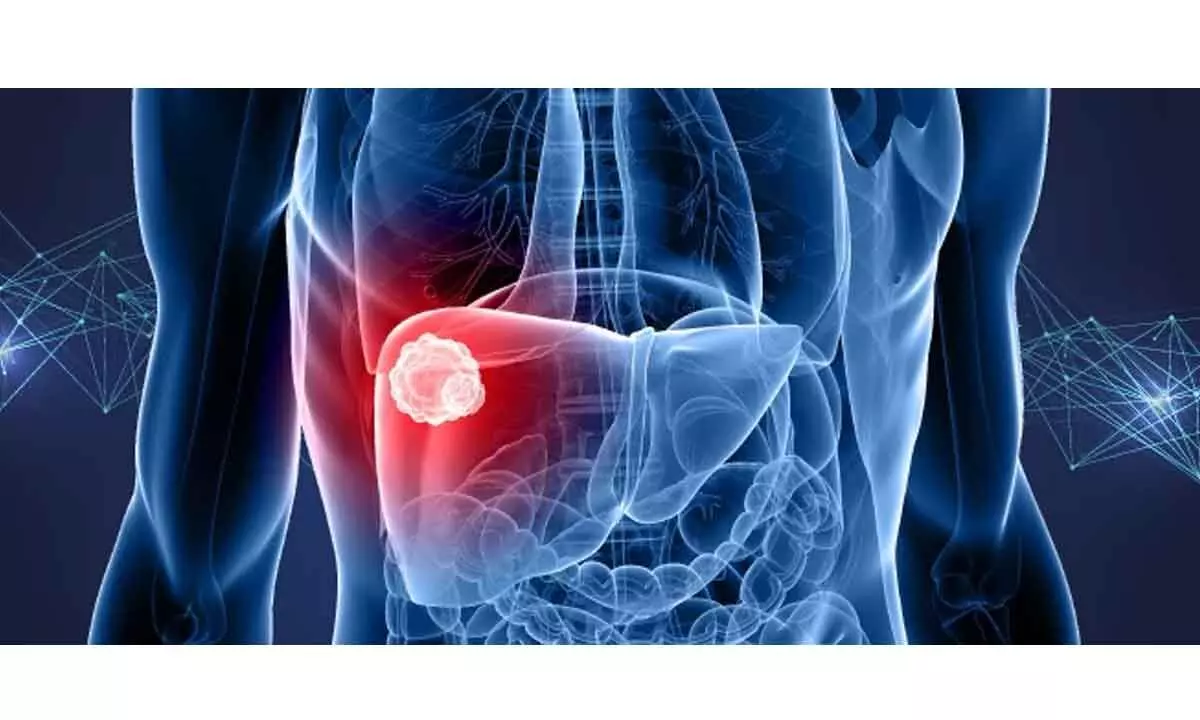 AMU faculty discovers common mechanism to prevent liver cancer