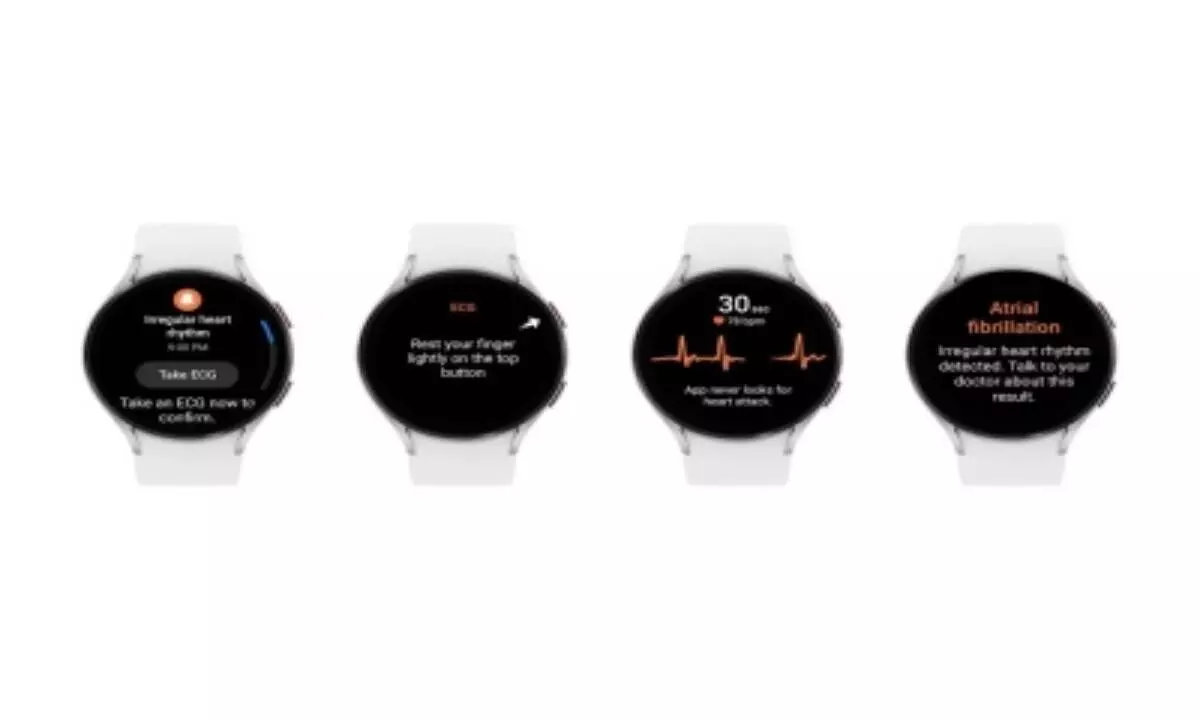 Samsung Galaxy Watchs Irregular Heart Rhythm Notification feature cleared by FDA