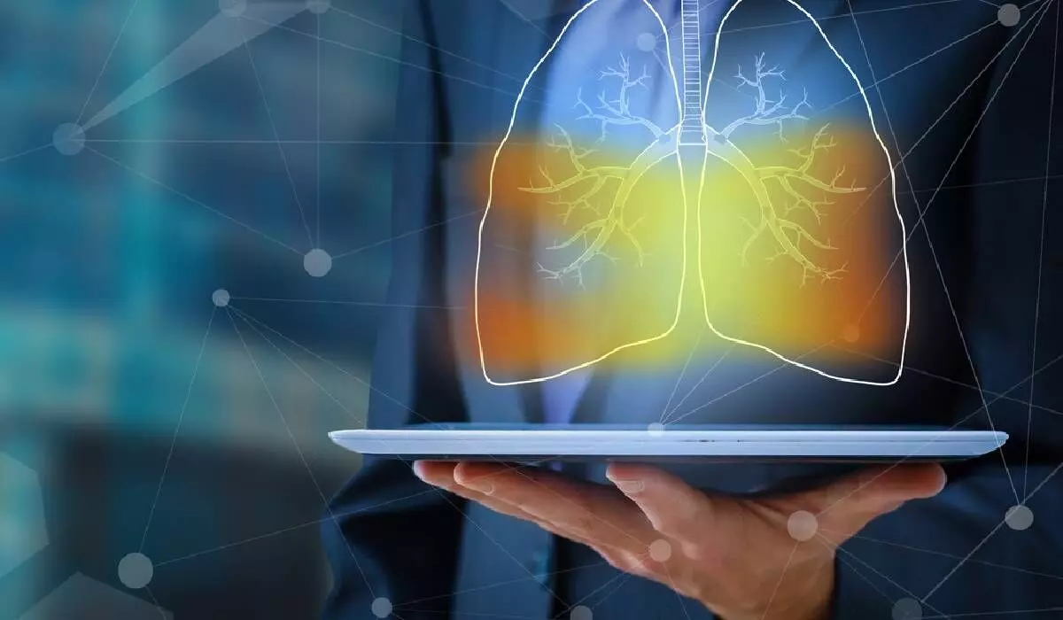 AIs ability to predict lung cancer in non-smokers