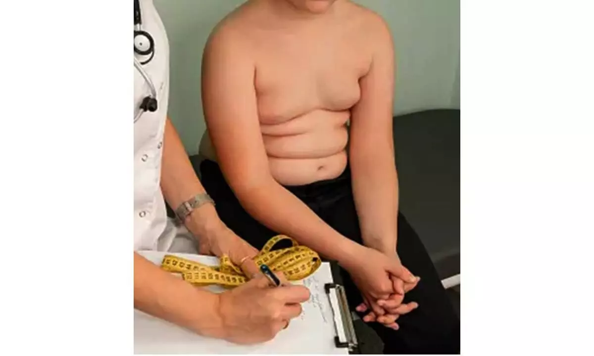 Early treatment may help curb child obesity: Study Early treatment may help curb child obesity: Study