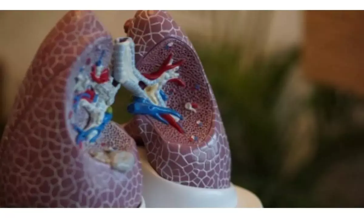 Scientists develop robot to maneuver through living lung tissue