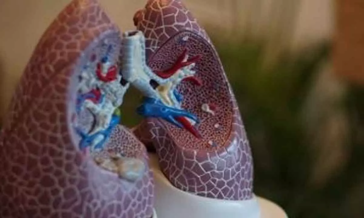 Scientists develop robot to pass through human lungs