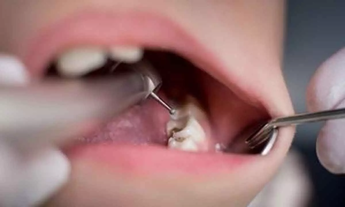 Tooth enamel damage occurs in people with celiac disease Tooth enamel damage occurs in people with celiac disease