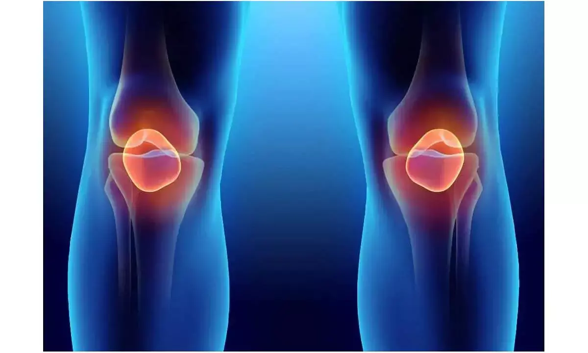 Epilepsy drug may help slow joint degeneration in osteoarthritis