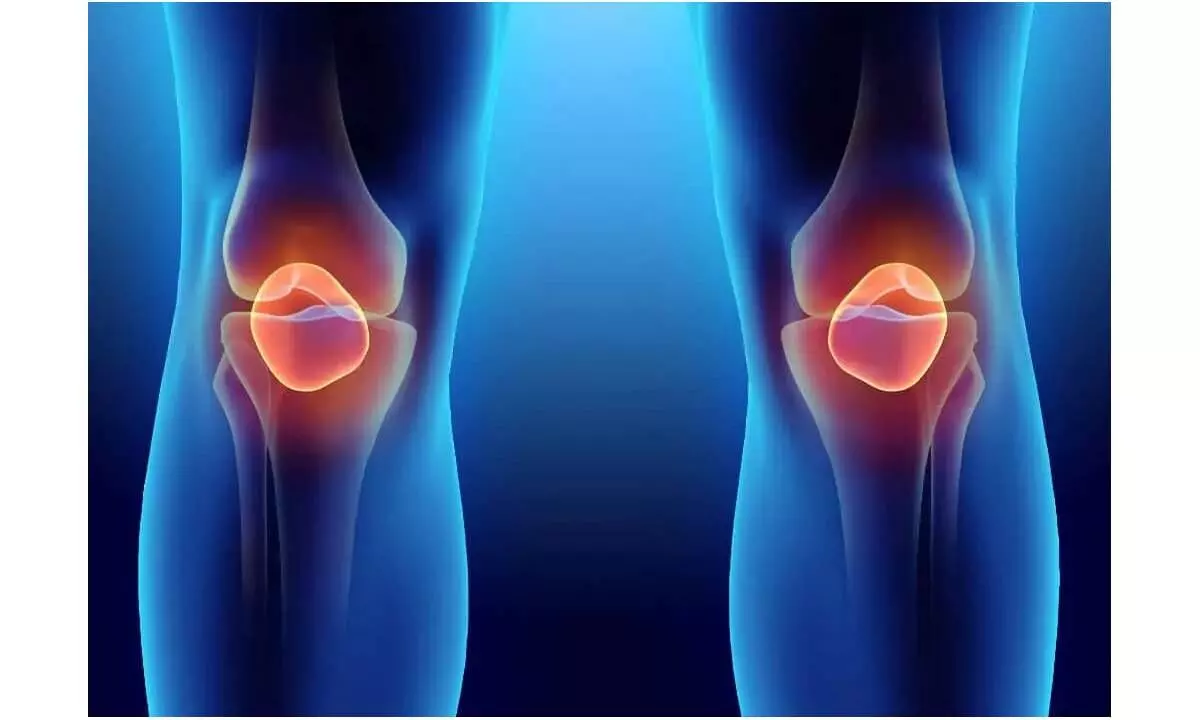 Epilepsy drug may help slow joint degeneration in osteoarthritis