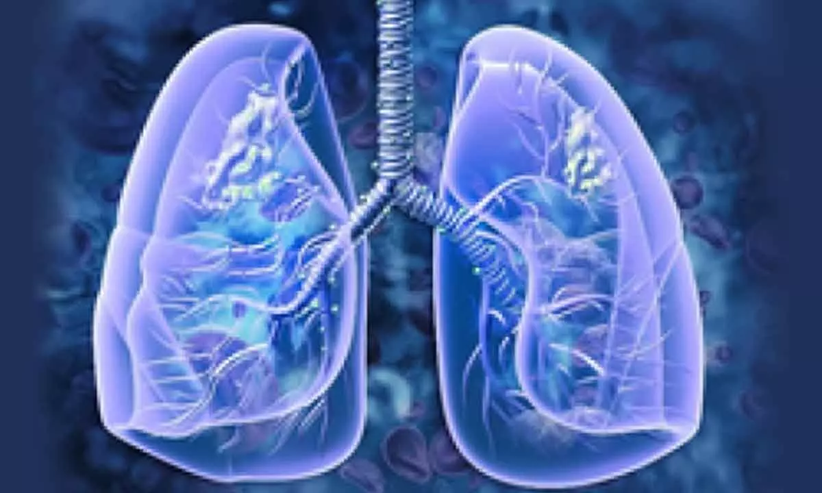 Fatal lung disease may have caused Covid deaths