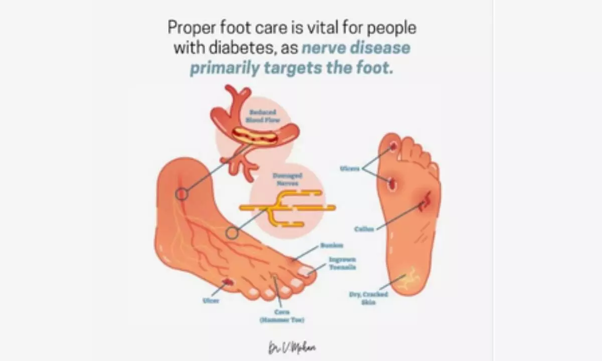 Heres how to take care of your foot health if you have diabetes