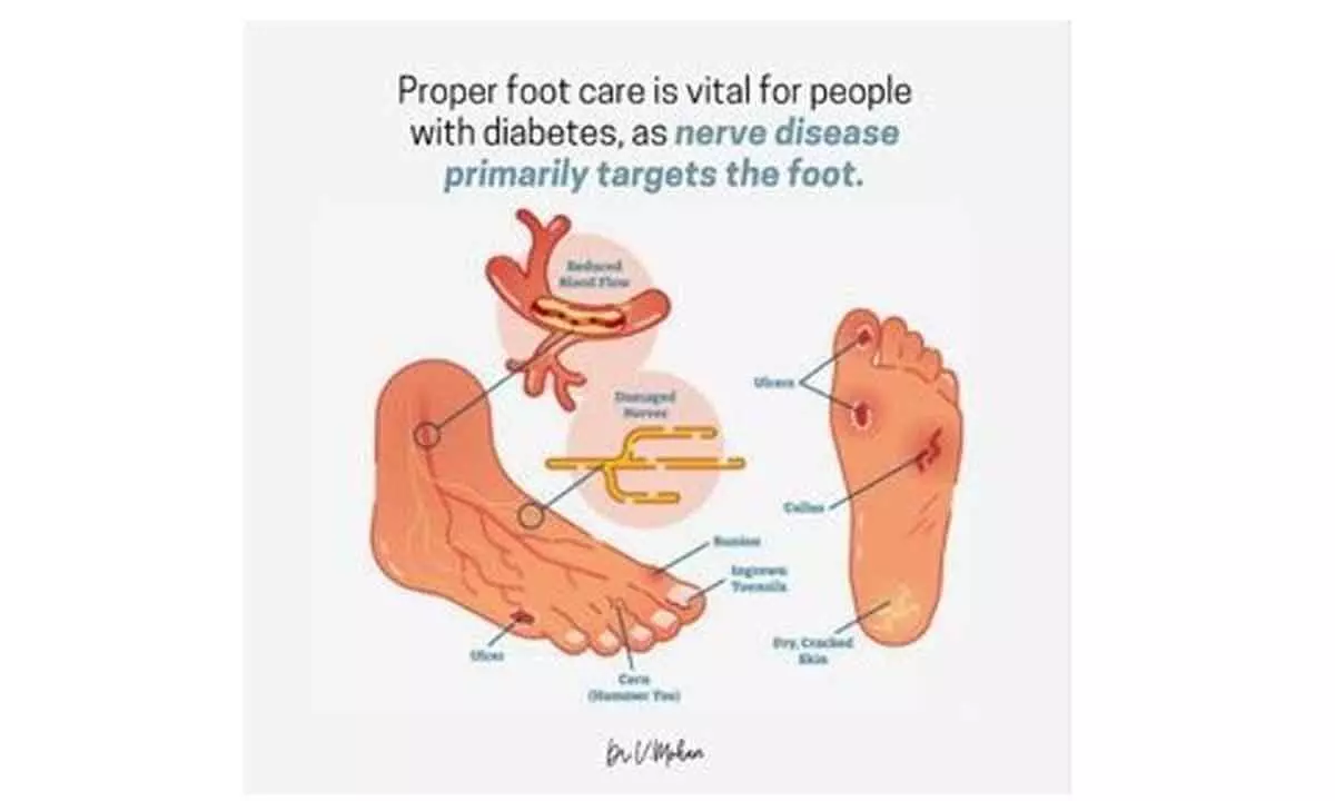 Proper foot health essential for people with diabetes