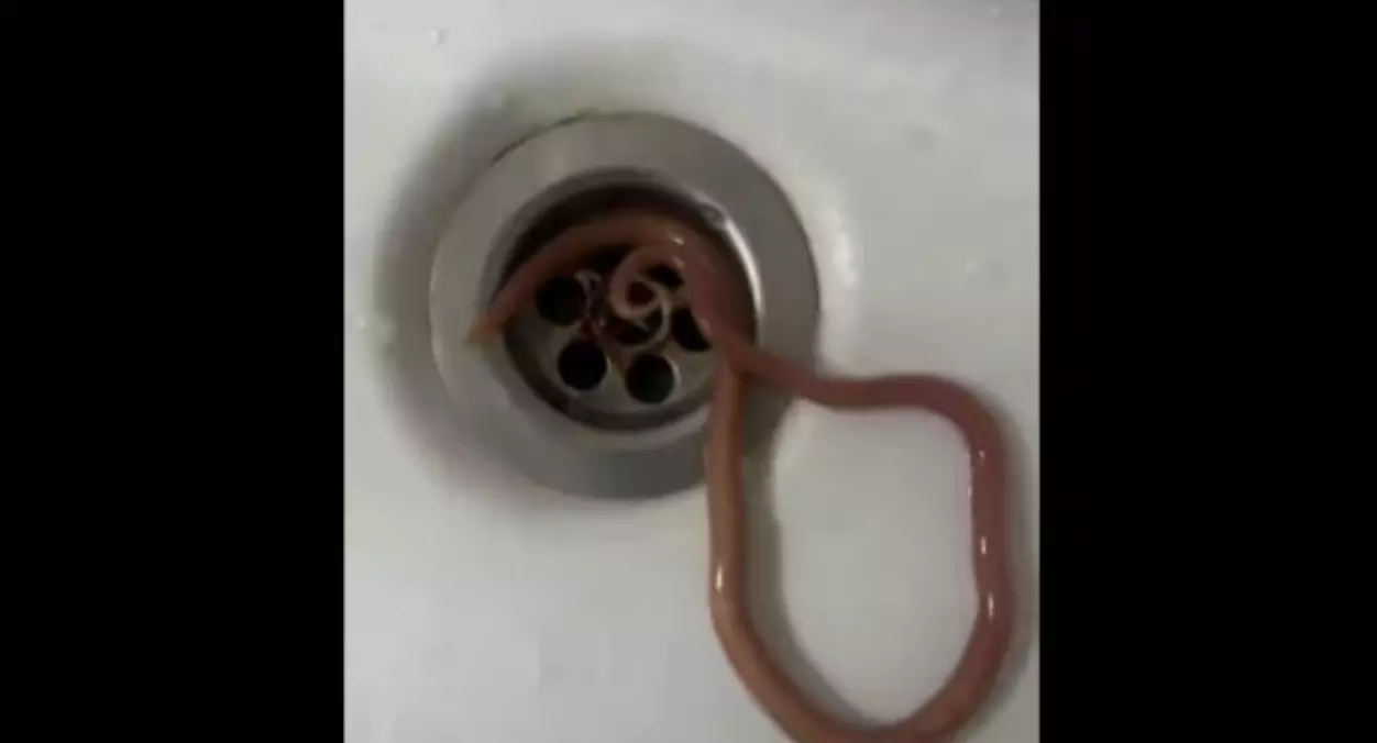 Not for faint hearted!!! Man vomits wriggling worm! Video