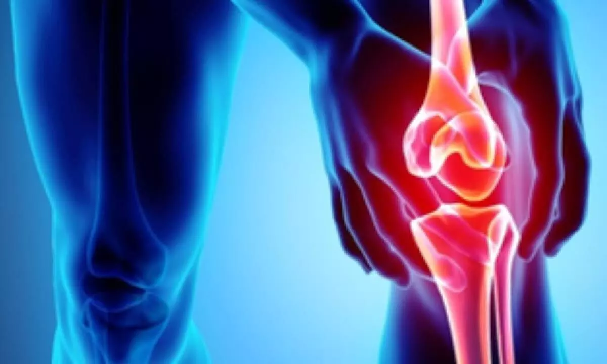 Early detection of osteoarthritis may allow therapy that improves joint health: Researchers Early detection of osteoarthritis may allow therapy that improves joint health: Researchers