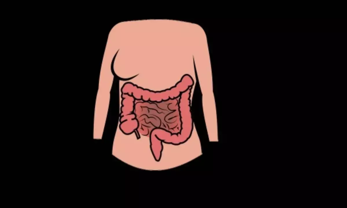 Late diagnosis of appendix cancer a concern, say experts