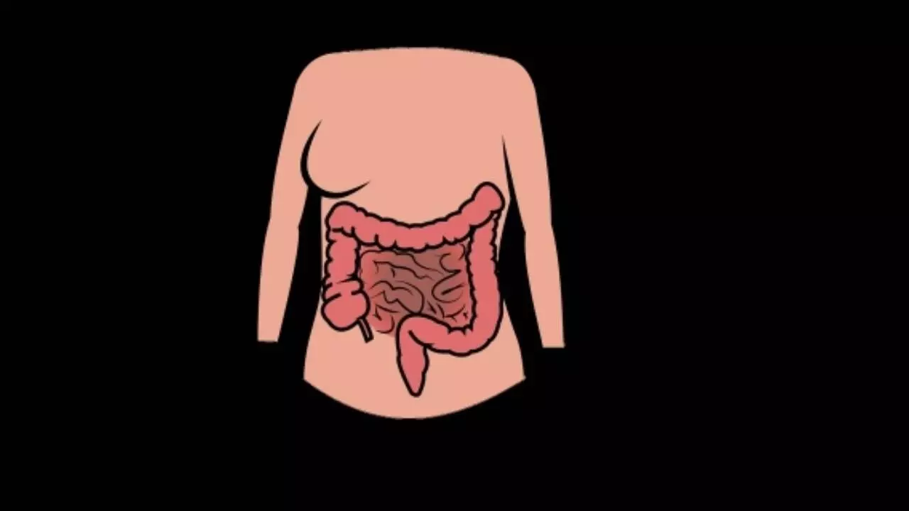 Late diagnosis of appendix cancer a concern, say experts Late diagnosis of appendix cancer a concern, say experts