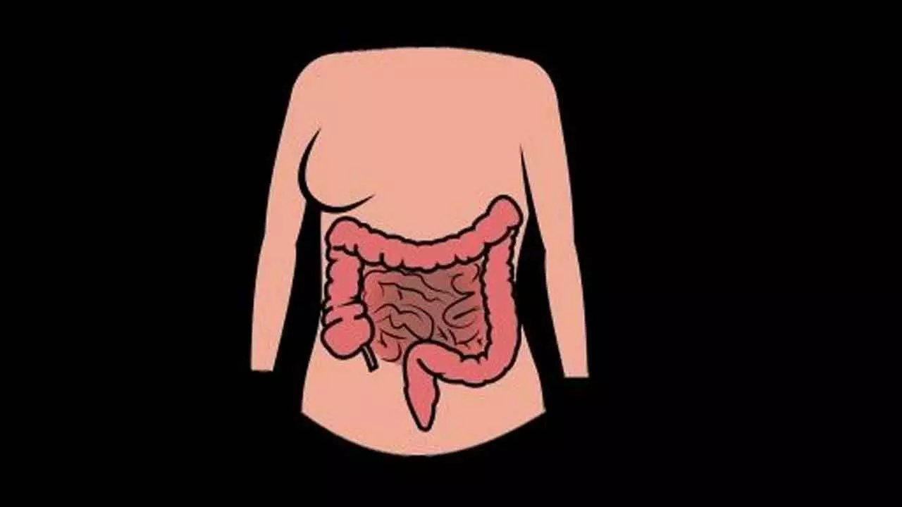 Difficult to diagnose asymptomatic appendix cancer until later stages Difficult to diagnose asymptomatic appendix cancer until later stages