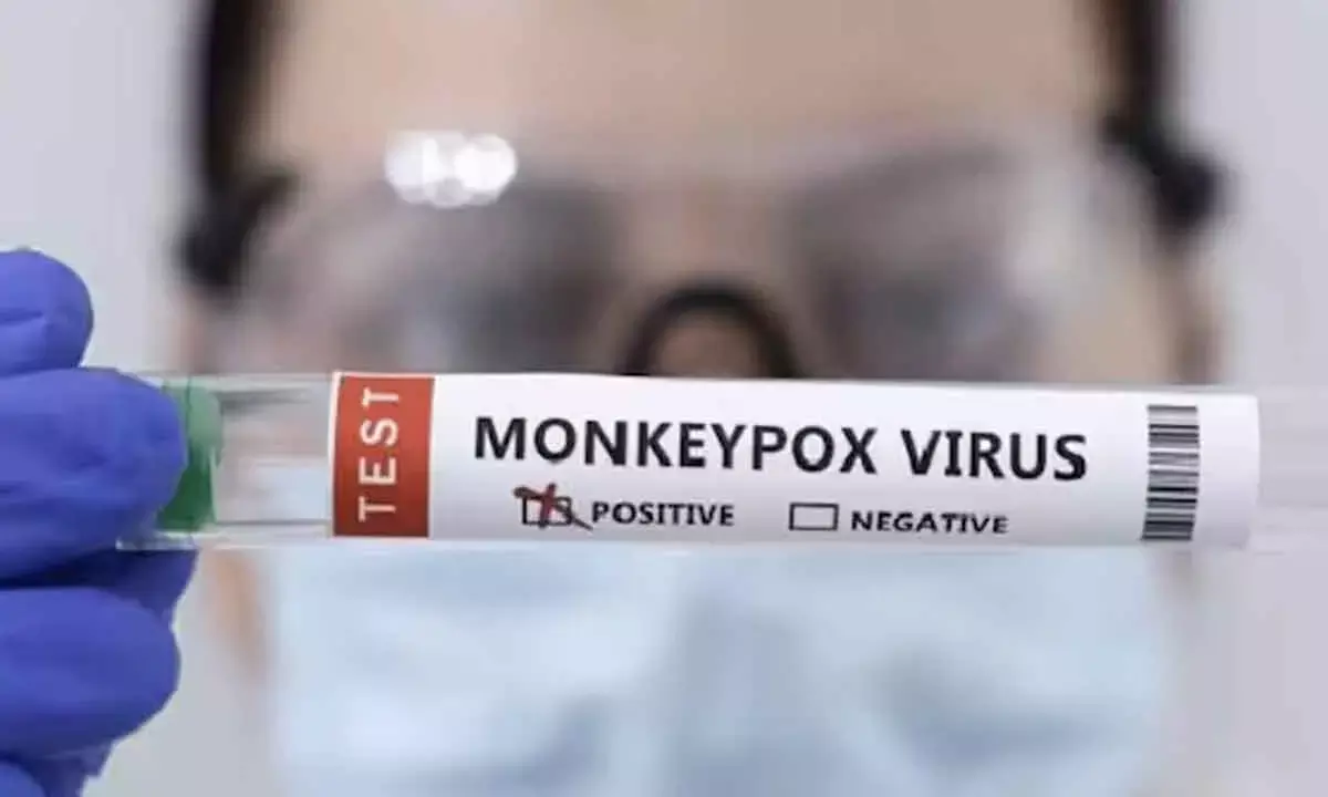 India on alert after Mpox cases in Sweden, Pakistan