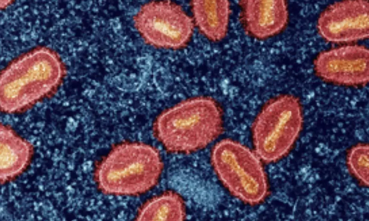 India must focus on genomic surveillance of Mpox virus to curb spread: Experts