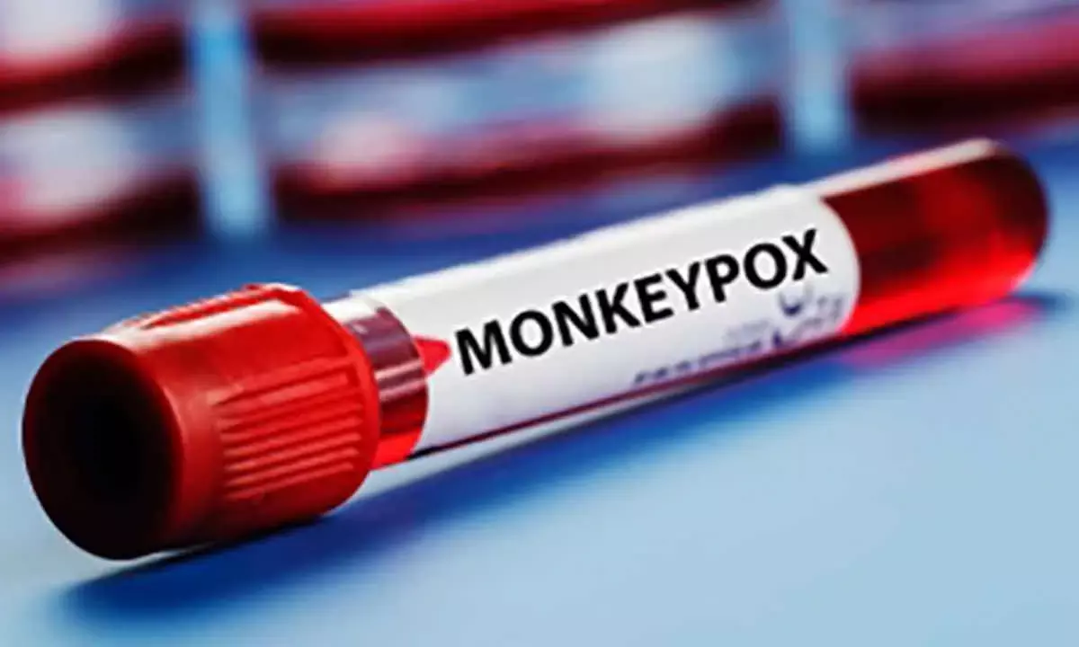 Philippines detects 1st mpox case with no travel history