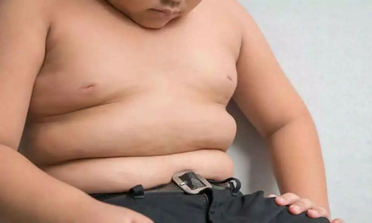 Childhood obesity linked to increased risk of skin diseases