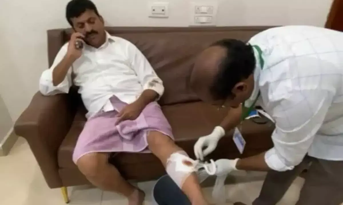 Minister Ponguleti suffers minor injury after falling off bike