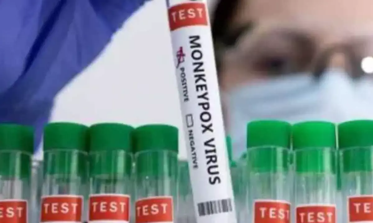 First suspected Mpox case identified in India