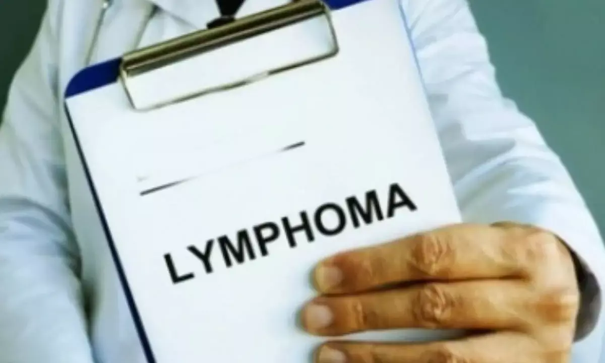 CAR-T Cell Therapy, Bone Marrow Transplant Boosting Lymphoma Outcomes: Experts