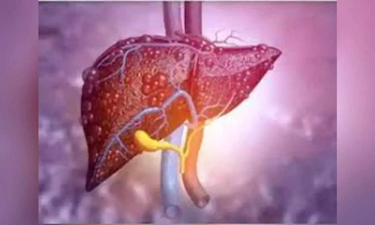 Diabetes, obesity increases risk of liver cancer relapse: Study