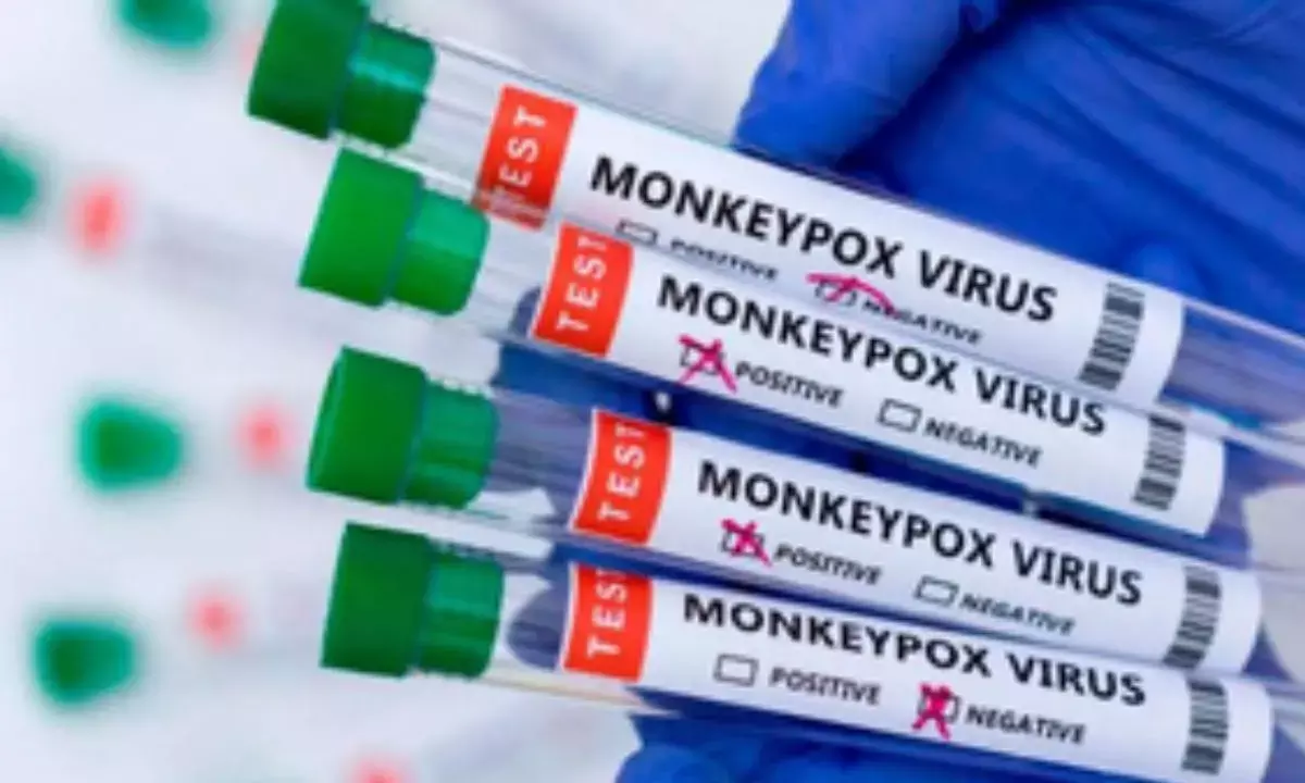 Twin studies show Bavarian Nordic’s Mpox vax efficacy wanes in 1 year