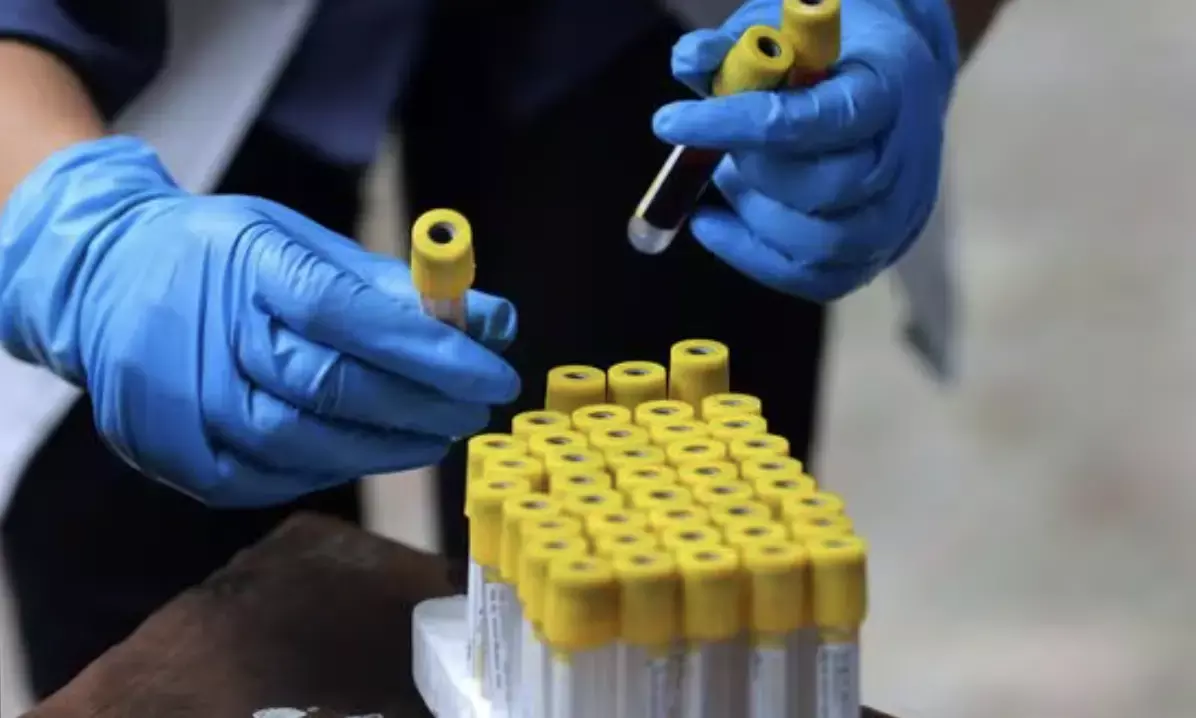 Health Ministry issues ethical guidelines for commercial use of leftover biomedical samples