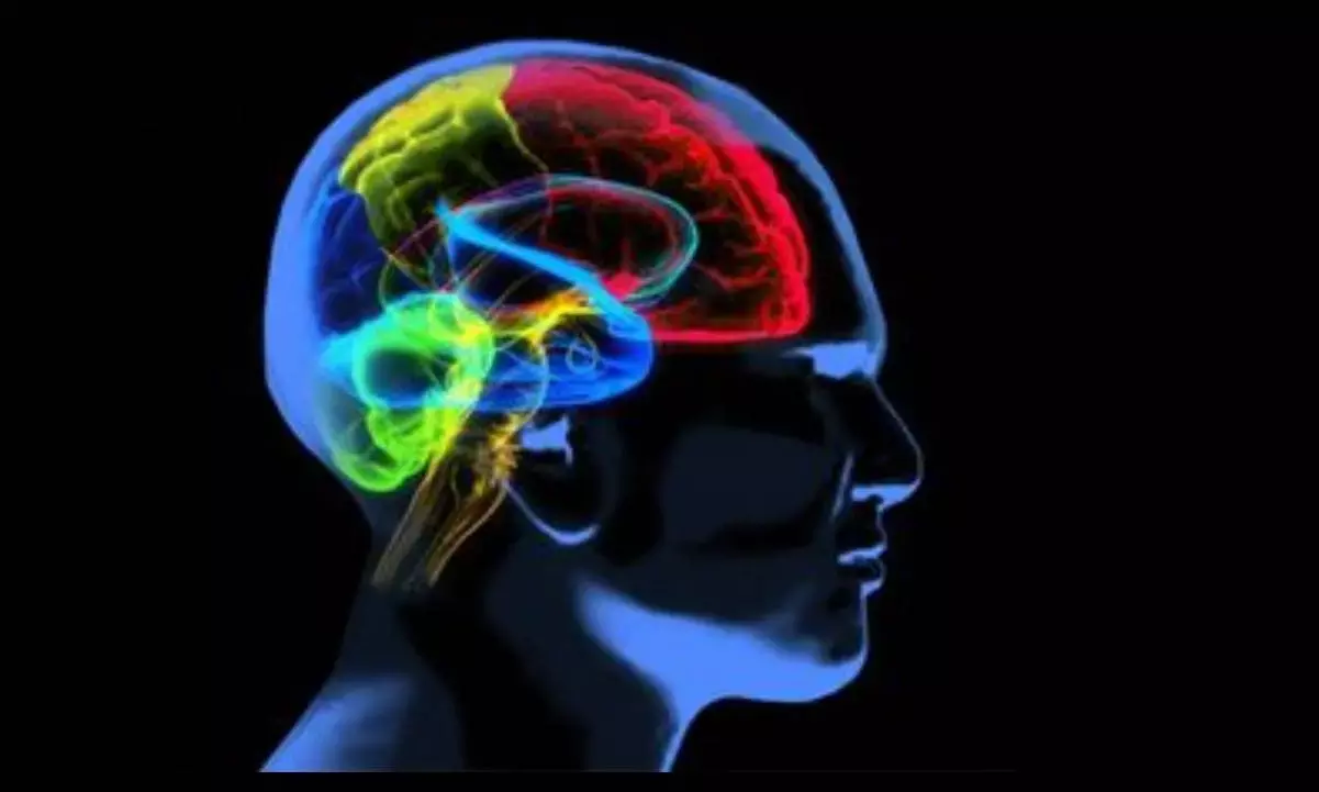 Study shows pattern of brain shrinkage varies between Alzheimer’s patients