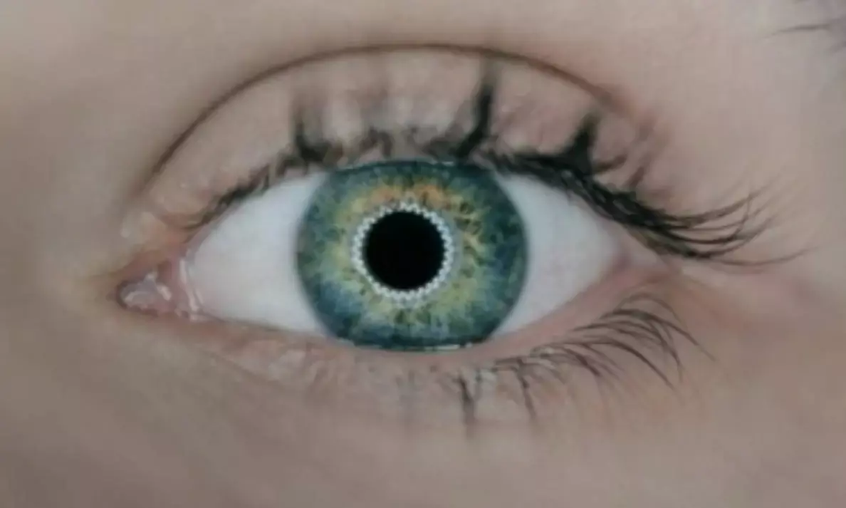 More than 85pc of blindness in India is preventable: Experts