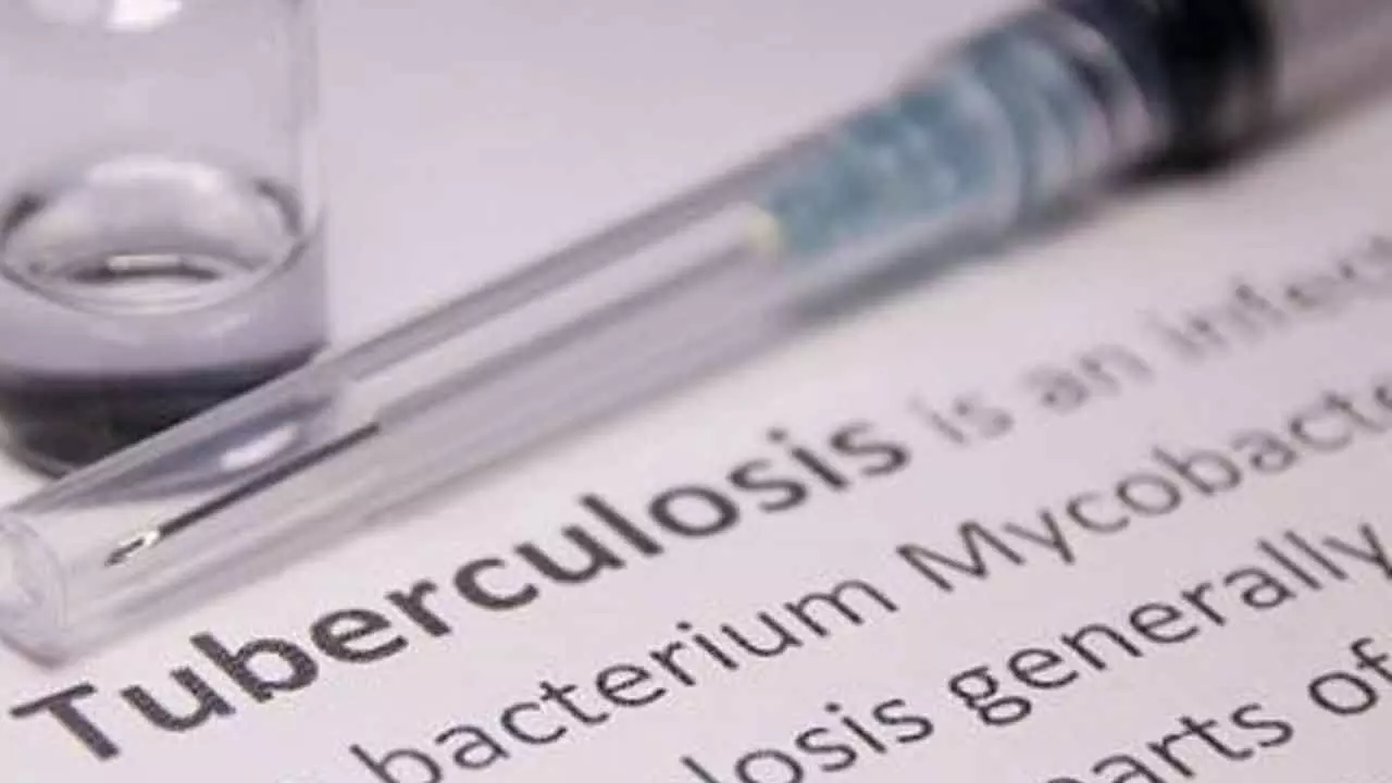 India Offers High Treatment Coverage Against TB: WHO India Offers High Treatment Coverage Against TB: WHO