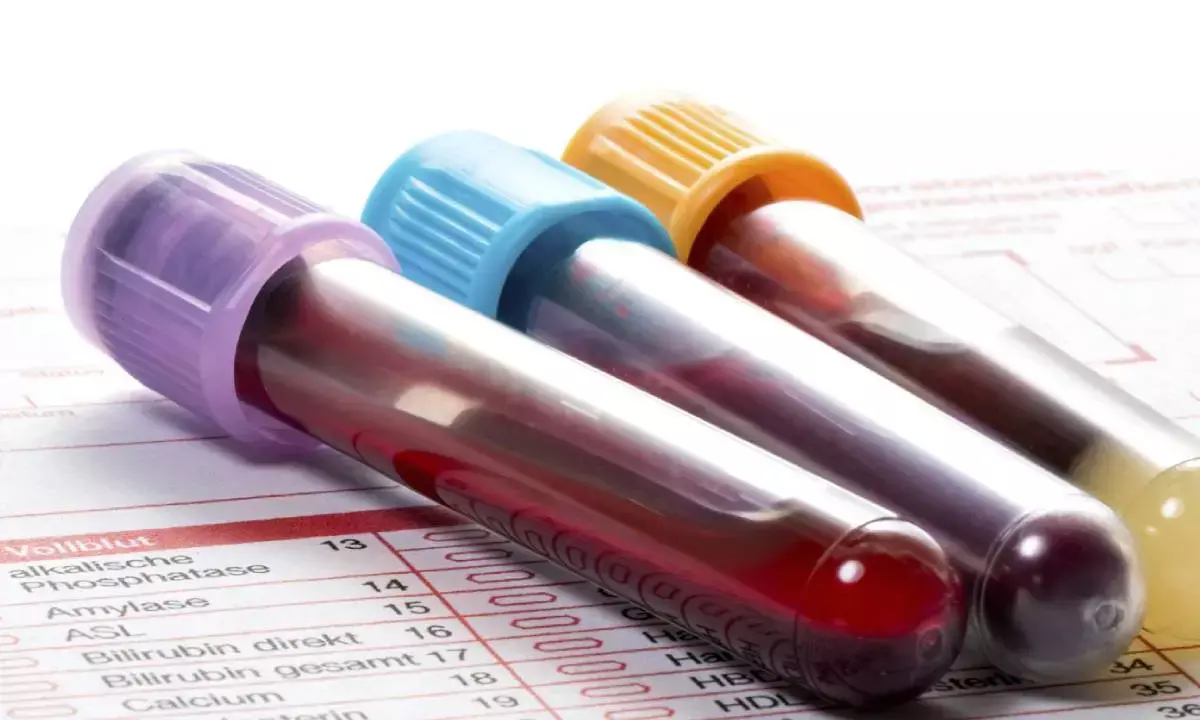 Blood-biomarker tests may aid in early diagnosis of Alzheimer’s: Report