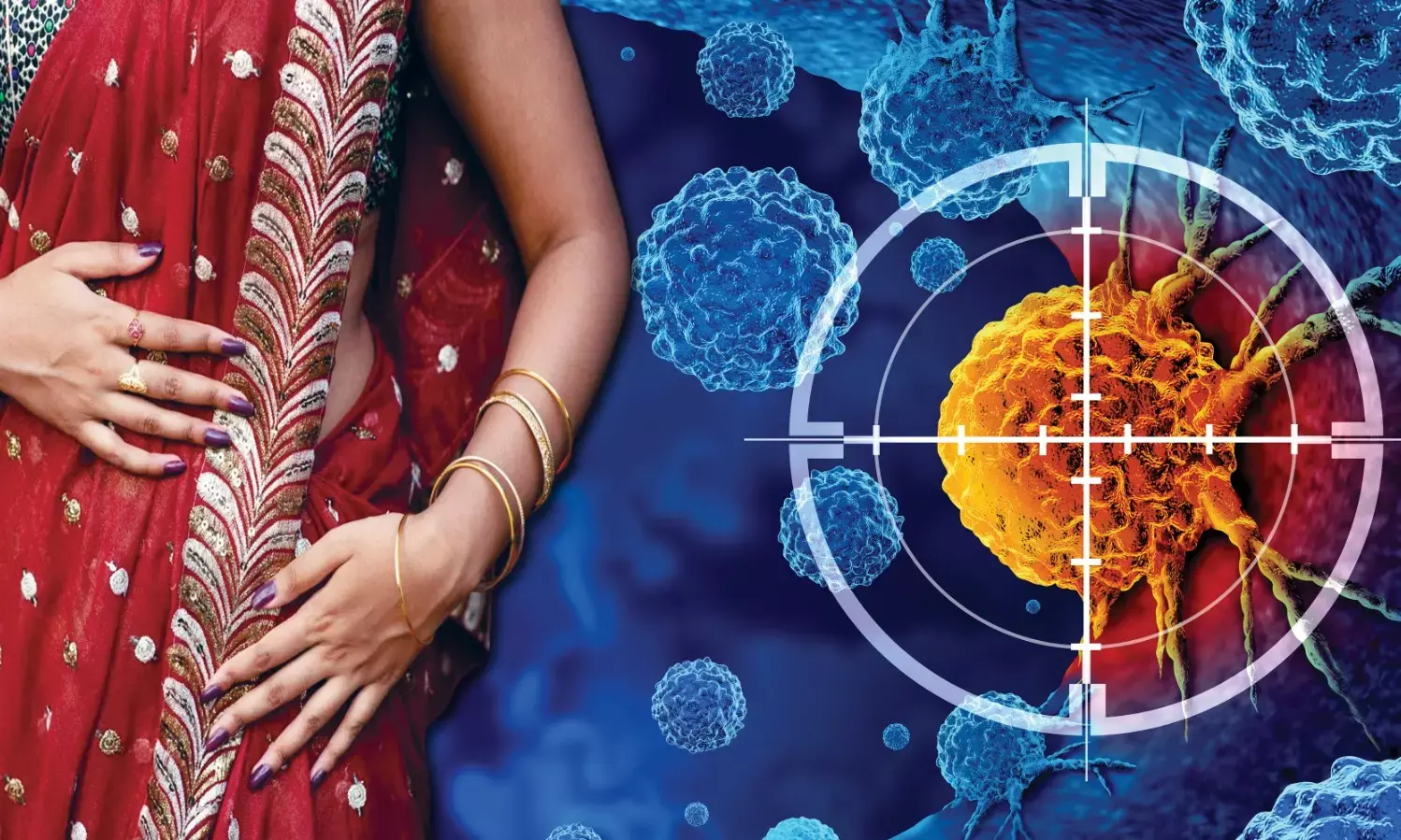What is Saree and Petticoat Cancer? Is It Real? How to Prevent It?