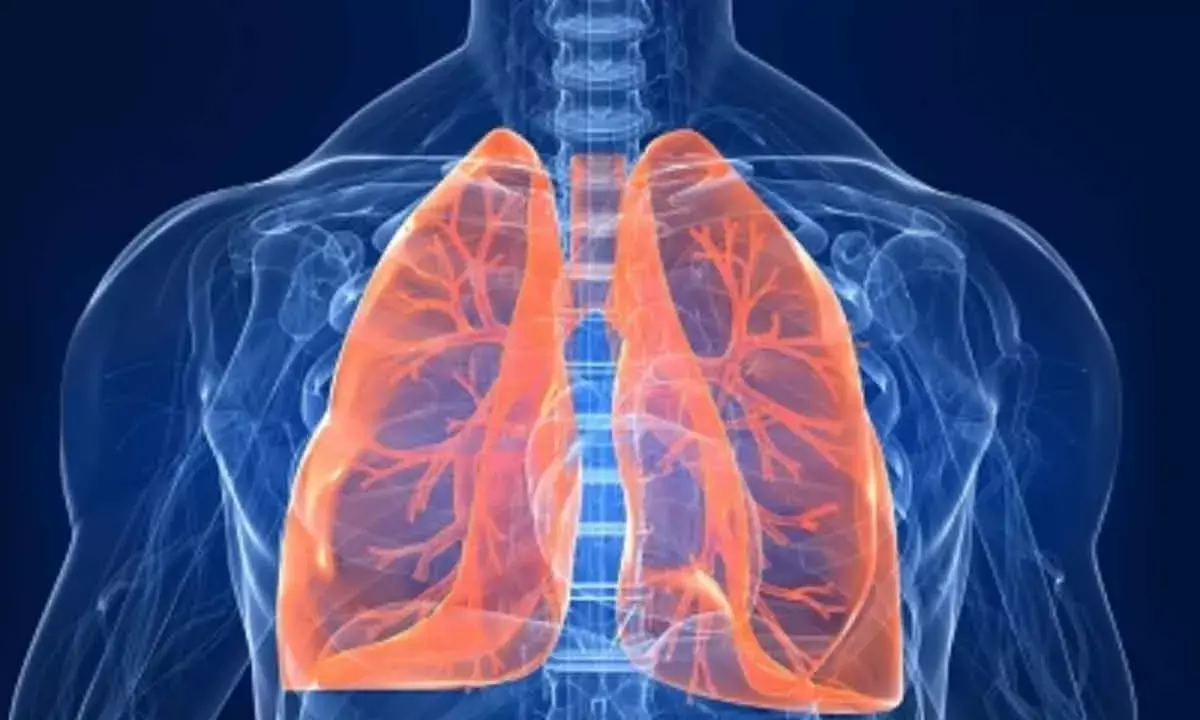 Fungal Infection May Turn Deadly In Lung Patients: AIIMS Study