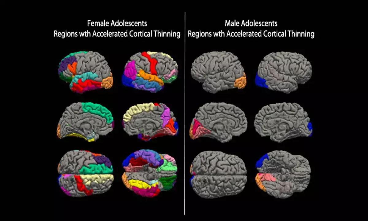The Damage Caused By Covid On The Developmental Brain Biology Of Teens Needs Prioritised Attention