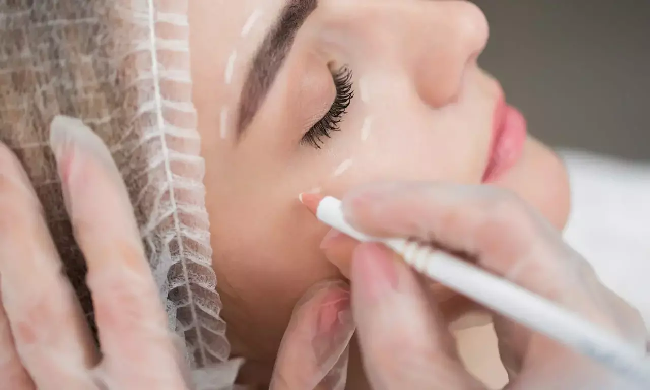 Why Choosing the Right Injector Matters for Botox Treatments