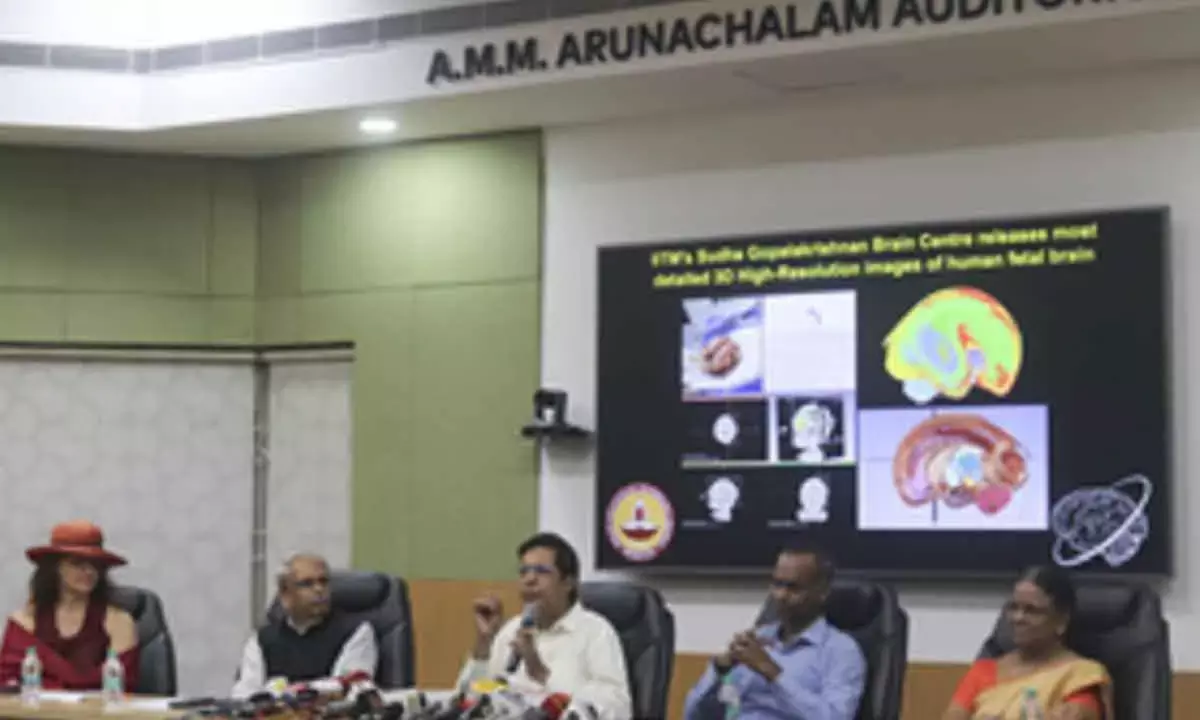 IIT-M Releases 1st 3D Images Of Human Foetal Brain