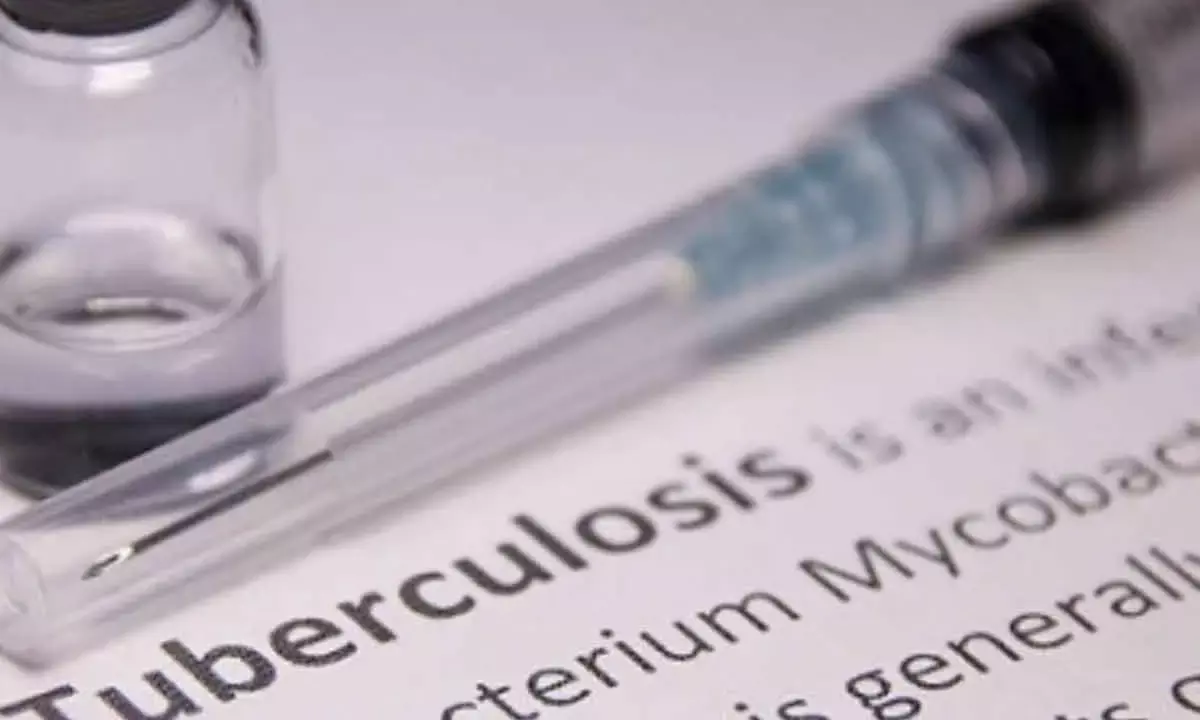 TB Patients Suffer High Costs Due To Lost Productivity