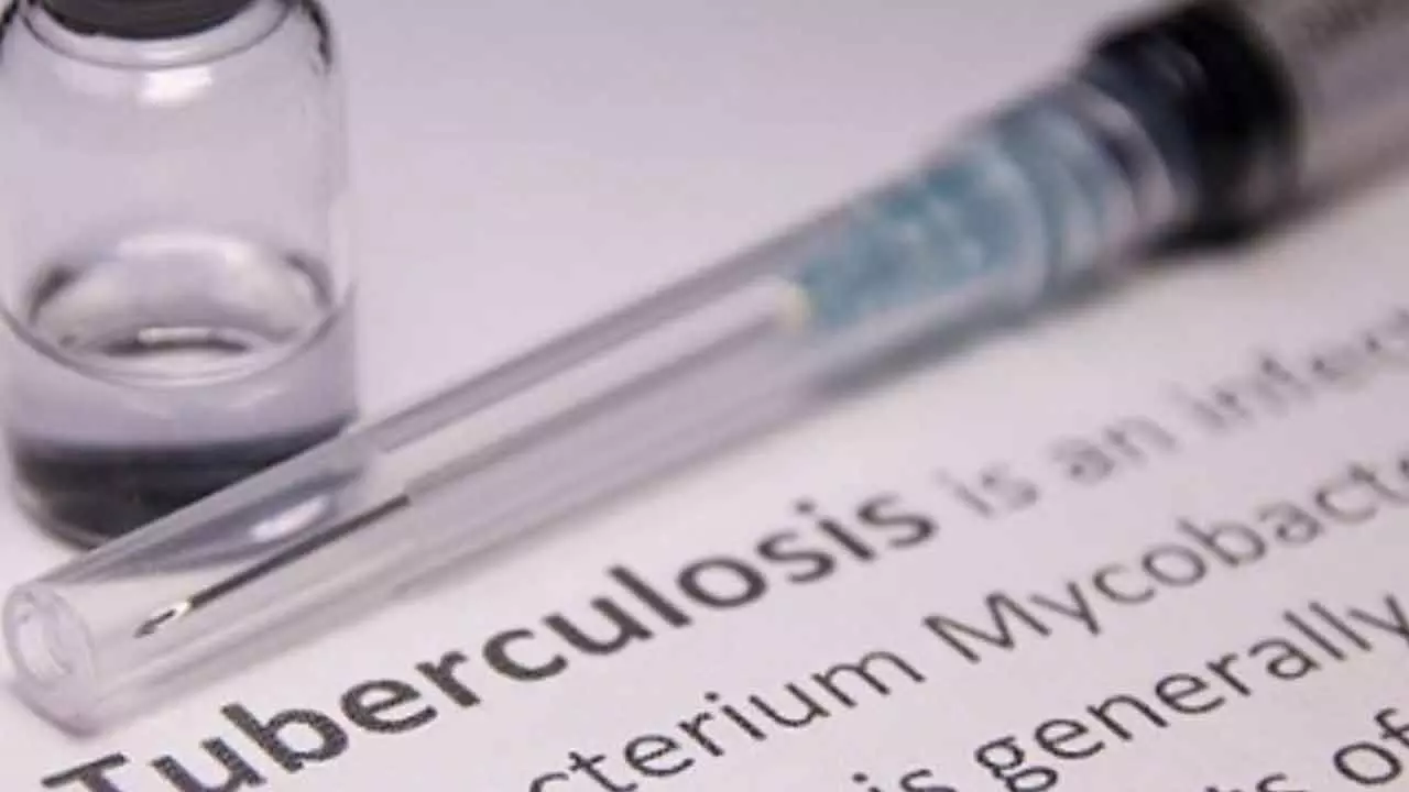 TB Patients Suffer High Costs Due To Lost Productivity TB Patients Suffer High Costs Due To Lost Productivity