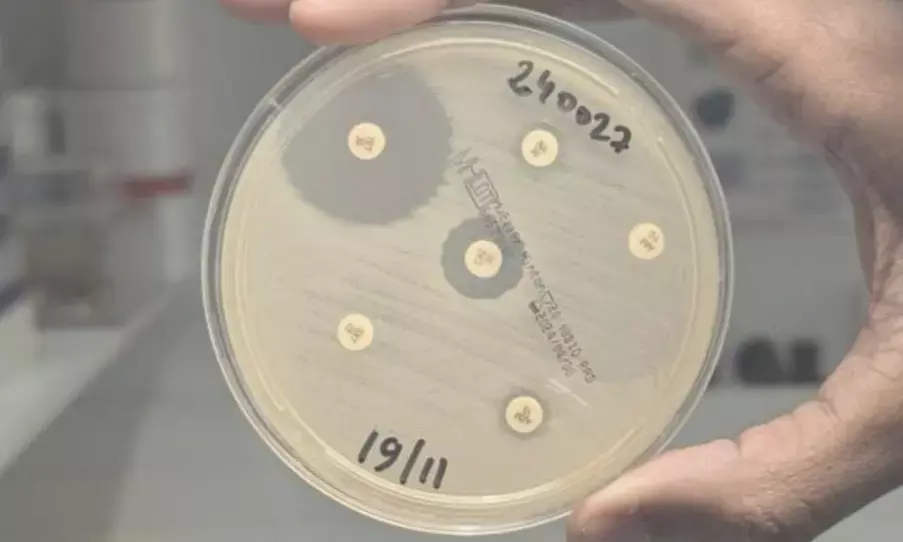 Highly drug-resistant Cholera strain spreads from Yemen to France