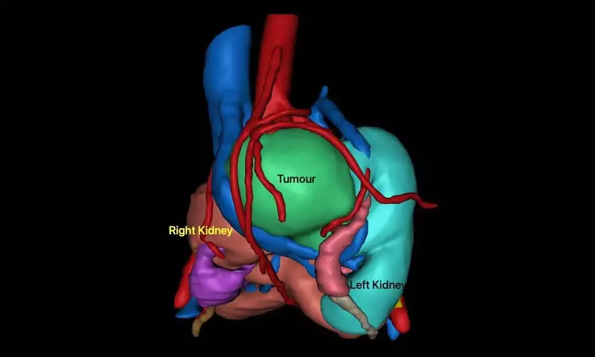 AINU Surgeons Perform Rare Keyhole Surgery