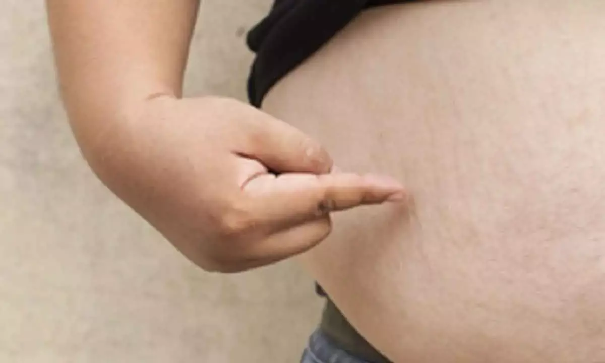 Eli Lilly’s Drug Likely To Dominate Global Obesity Market: Report