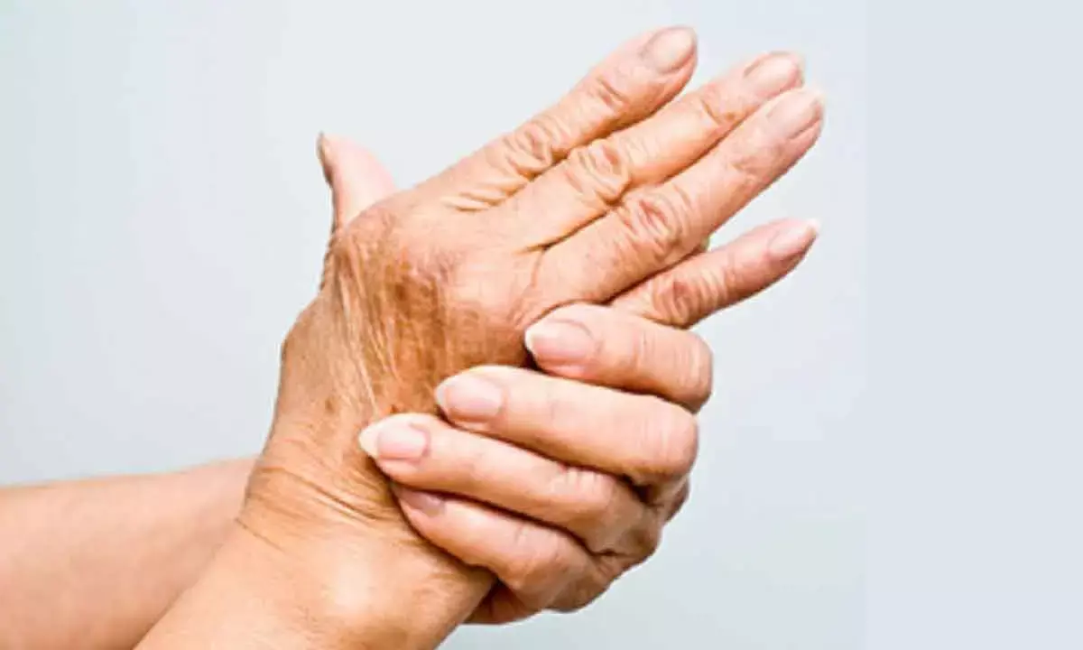 AI Method To Trace Arthritis Early In High-Risk Patients