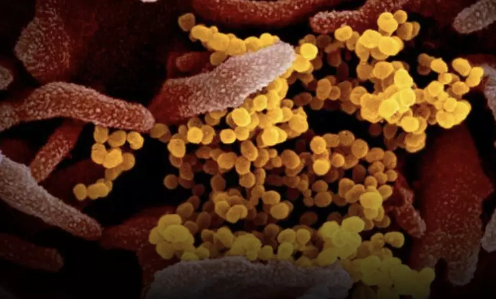 India registers over 200 HMPV cases in 2024; scientists confirm it is not a new virus India registers over 200 HMPV cases in 2024; scientists confirm it is not a new virus