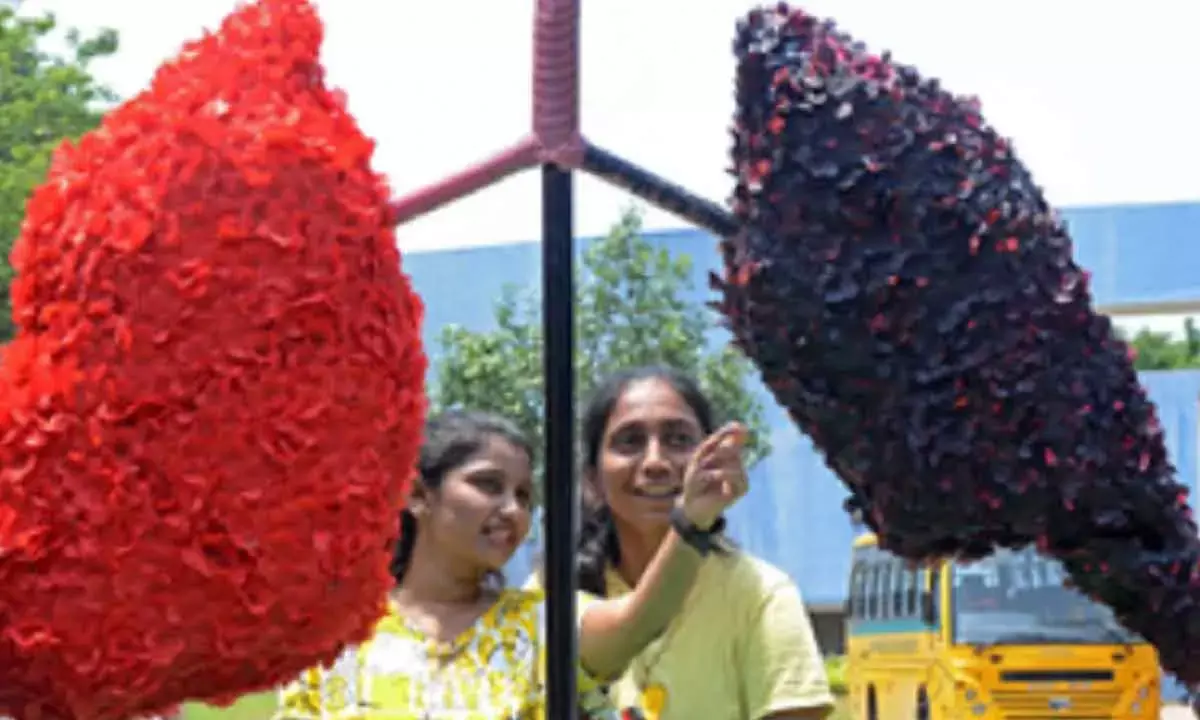 After Lung Transplant, Women Will Live Longer Than Men, Says Study